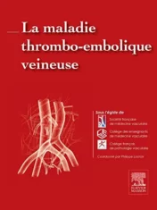 La maladie thrombo-embolique veineuse (Hors collection) (French Edition) (Original PDF