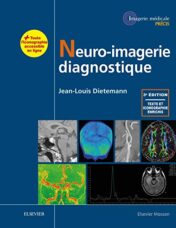 Neuro-imagerie diagnostique, 3e