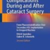 Complications During and After Cataract Surgery From Phacoemulsification Over Secondary IOL Implantation to Dropped Nucleus 2022 original pdf