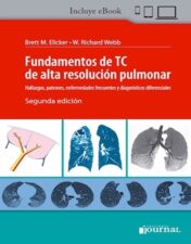 Fundamentos De Tc De Alta Resolucion Pulmonar Hallazgos, 2ª edición 2021 High Quality Image PDF