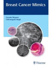 Breast Cancer Mimics is an enthralling collection of case scenarios collected by radiologists across the globe, highlighting the one common line of thought– benign breast lesions that resemble malignancies.