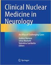 Clinical Nuclear Medicine in Neurology An Atlas of Challenging Cases 2022 Original pdf