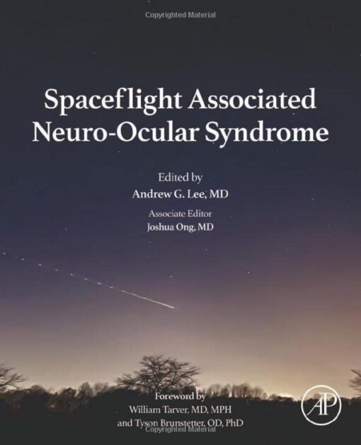 Spaceflight Associated Neuro-Ocular Syndrome (EPUB)