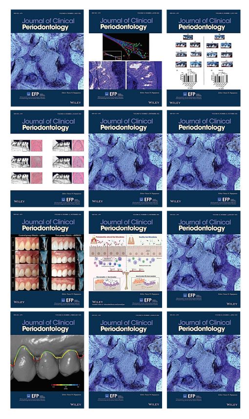 Journal of Clinical Periodontology 2022 Full Archives (True PDF)