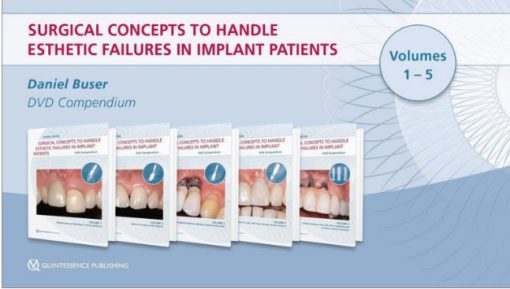 Surgical Concepts to Handle Esthetic Failures in Implant Patients