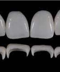Prosthetic Rehabilitation on Natural Teeth