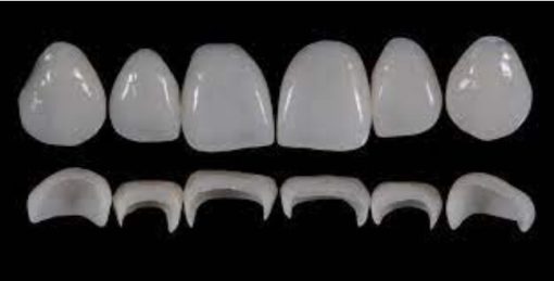 Prosthetic Rehabilitation on Natural Teeth