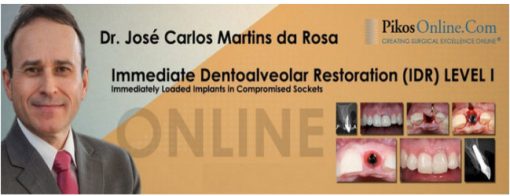 Immediate Dentoalveolar Restoration (IDR) Level 1