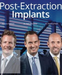 Post-Extraction Implants