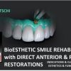 BioEsthetic Smile Rehabilitations with Direct Anterior & Posterior Restorations