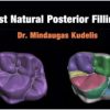 Fast Natural Posterior Fillings