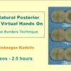 Fast Natural Posterior Fillings Virtual Hands On