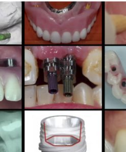 Gidedental A-Z in Restorative Implant Dentistry