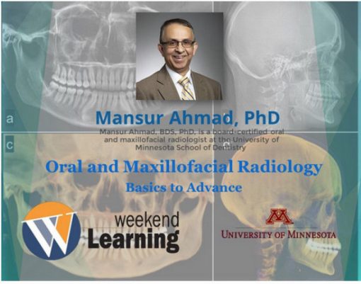 Oral and Maxillofacial Radiology: Basics to Advanced