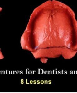 Removable Dentures for Dentists and Technicians