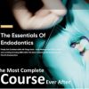 The Essentials of Endodontics