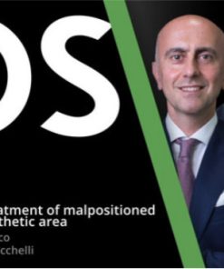 Treatment of Malpositioned Implants in the Esthetic Zone