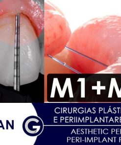 Aesthetic Periodontal and Peri-Implant Plastic Surgeries