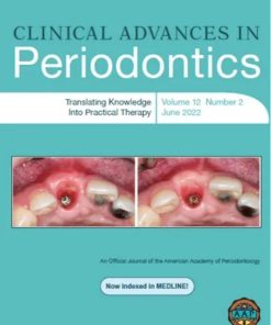 Clinical Advances in Periodontics