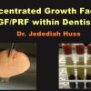 Concentrated Growth Factors