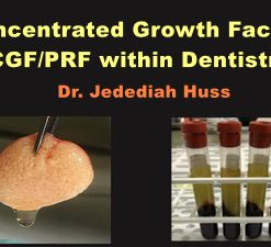 Concentrated Growth Factors