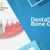 DentalXP Bone Grafts