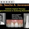 Esthetic Implant Therapy