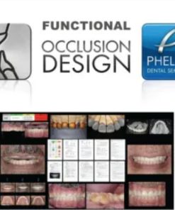Functional Occlusion Design Dental Seminars