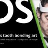 Hirata’s Tooth Bonding Art