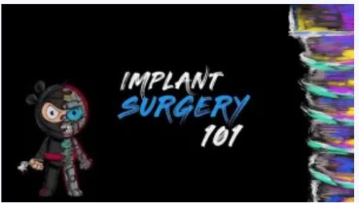 Implant Ninja Implant Surgery 101