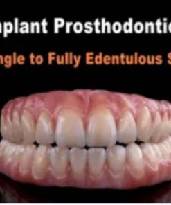 Implant Prosthodontics – From Single to Fully Edentulous Solutions