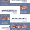 Implant-Supported Restorations – Vol. 1- 4