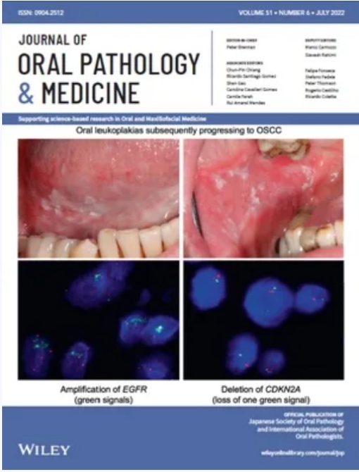 Journal of Oral Pathology and Medicine