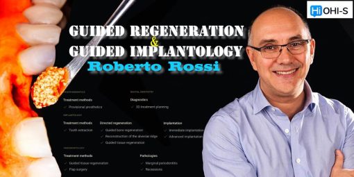 Guided Regeneration & Guided Implantology