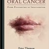 Oral Cancer 