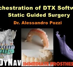Orchestration of DTX Software Static Guided-Surgery