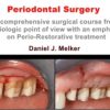 Periodontal Surgery: A Comprehensive Surgical Course