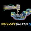 The Implant Guides 101 Course