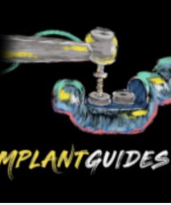 The Implant Guides 101 Course