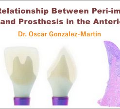 The Relationship Between Peri-implant Tissue and Prosthesis in the Anterior Area