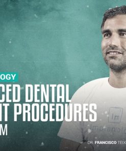 Advanced Dental Implant Procedures