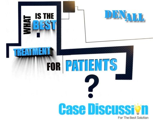 DENALL What is the Best Treatment for Patients
