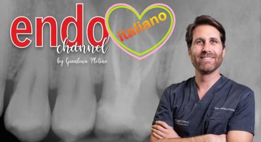 Endo Channel, L'Eccellenza nel Trattamento Endodontico Reso Facile / Gianluca Plotino 