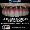 LearnyLib Le Bridge Complet sur Implant