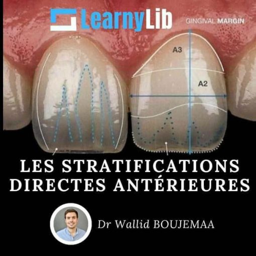 LearnyLib Les Stratifications Directes Anterieures