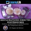 LearnyLib Restaurations Directes Postérieures