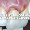 Mastery Academy Veneer Preparation and Administration