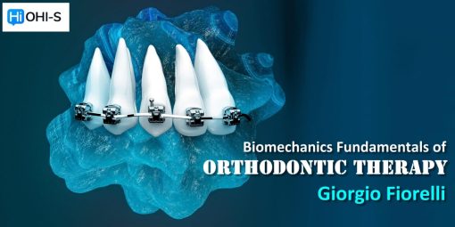 OHI-S Biomechanics Fundamentals of Orthodontic Therapy