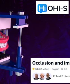 OHI-S Occlusion and Implants