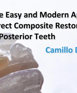 OHI-S The Easy and Modern Approach for Direct Composite Restorations in Posterior Teeth